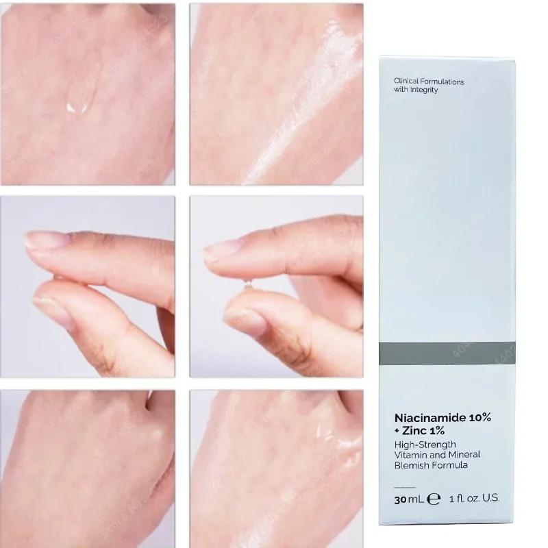 Niacinamide Magnesium Whitenin - огляд і ціна Alpha Lipoic Cream