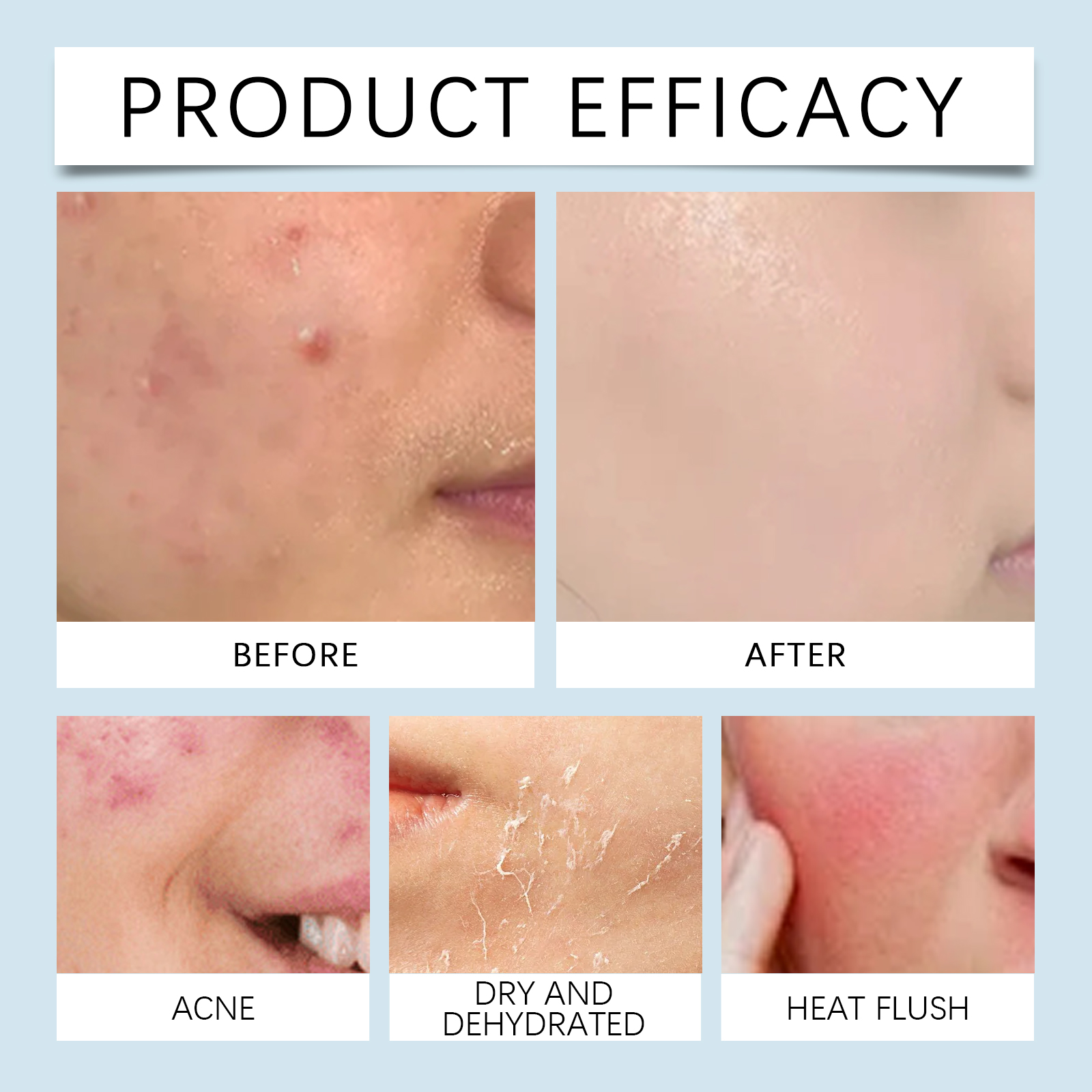 Hydrating roller Serum 0.25mm  - огляд і ціна Luxury Skincare Collection
